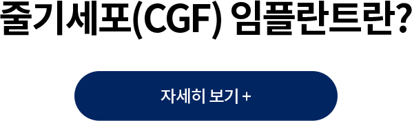 �ٱ⼼��(CGF) ���ö�Ʈ��?